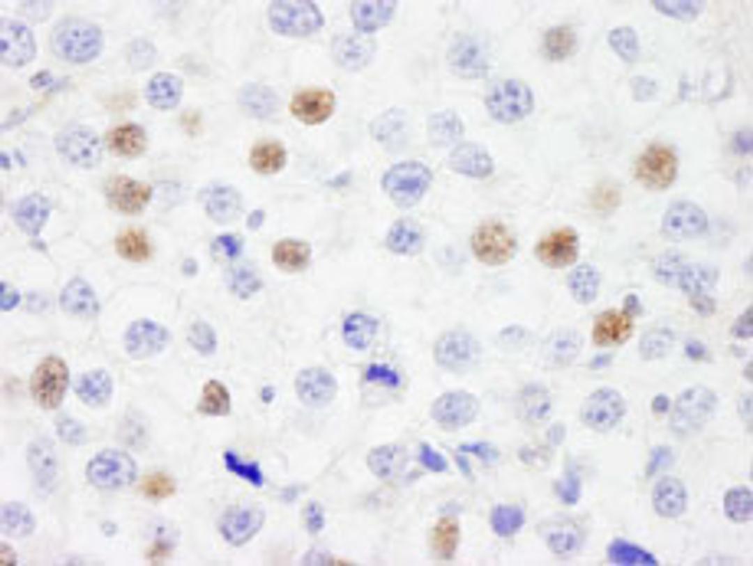 Detection of human IRF3 by immunohistochemistry.