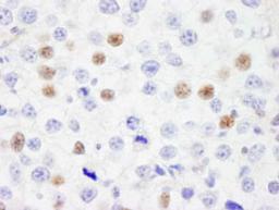 Detection of human IRF3 by immunohistochemistry.