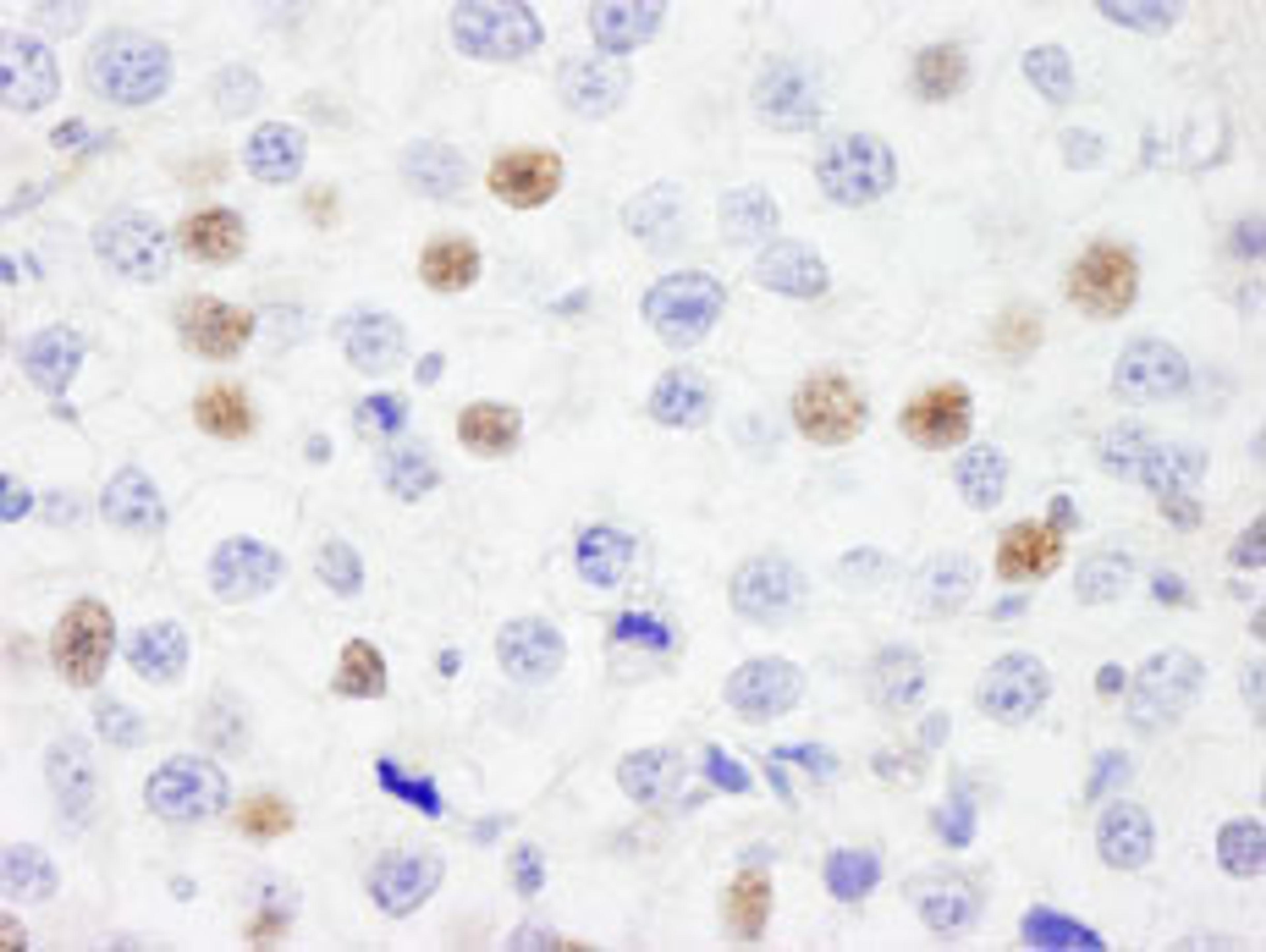 Detection of human IRF3 by immunohistochemistry.