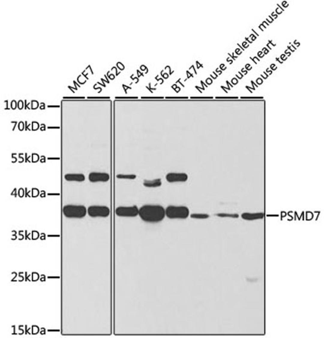 Western blot - PSMD7 antibody (A5356)