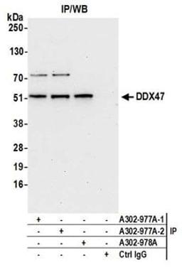 Detection of human DDX47 by western blot of immunoprecipitates.