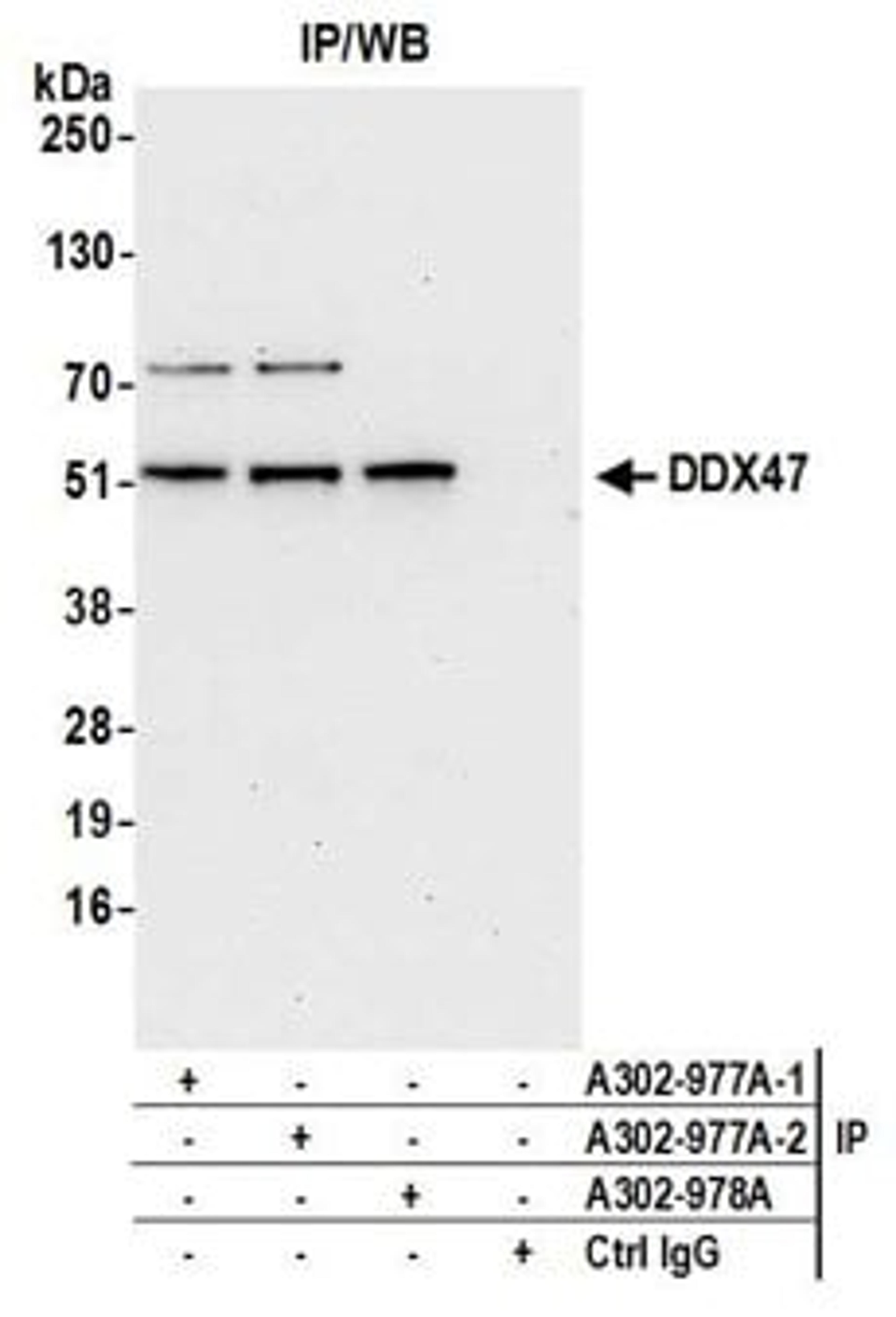 Detection of human DDX47 by western blot of immunoprecipitates.