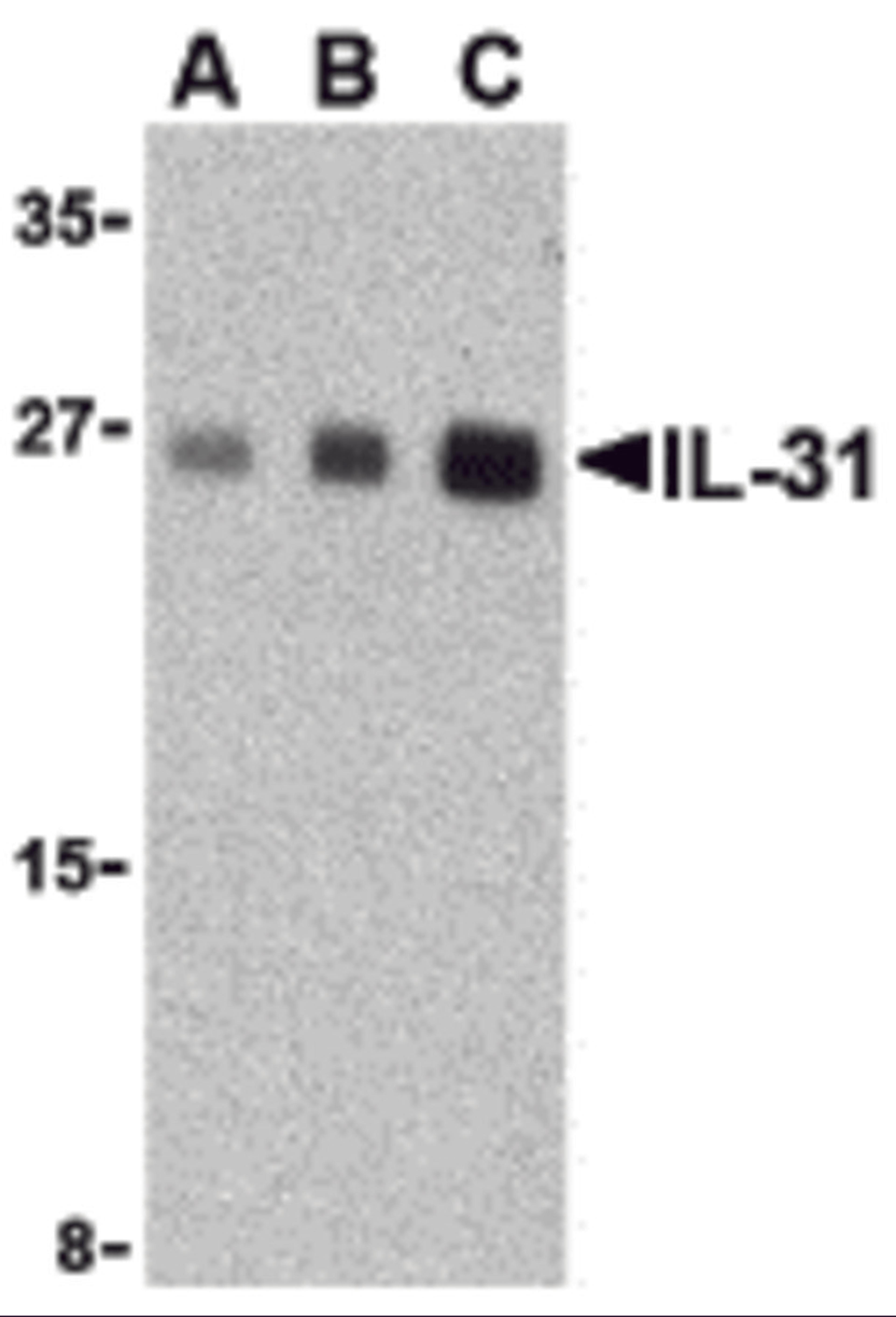 Western blot analysis of IL-31 in human skeletal muscle tissue lysate with IL-31 antibody at (A) 2.5, (B) 5 and (C) 10 μg/mL.