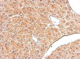 Immunohistochemistry: Amphiphysin Antibody [NBP1-32505] - Paraffin-embedded U87 xenograft. Antibody at dilution of 1:500.