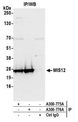 Detection of human MIS12 by western blot of immunoprecipitates.