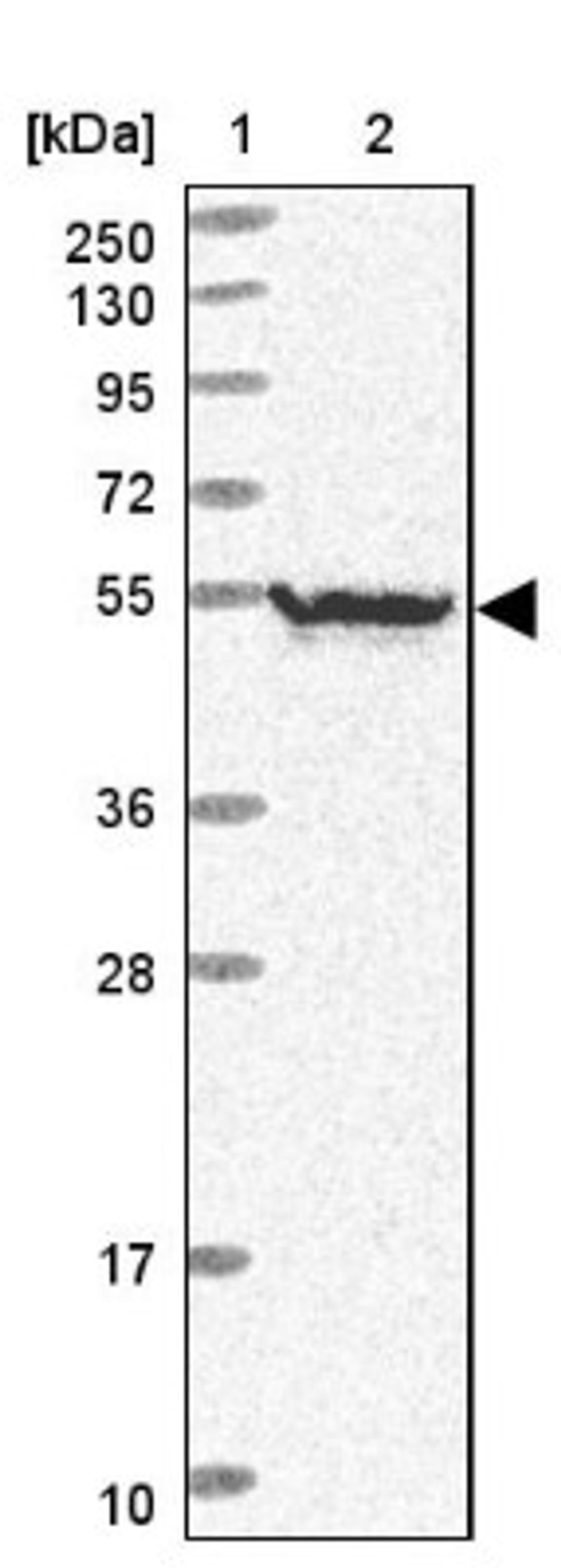 Western Blot: Neuro D4 Antibody [NBP2-13932] - Lane 1: Marker [kDa] 250, 130, 95, 72, 55, 36, 28, 17, 10<br/>Lane 2: Human cell line RT-4