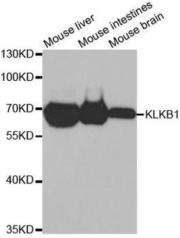 Western blot analysis of extracts of various cell lines using KLKB1 antibody