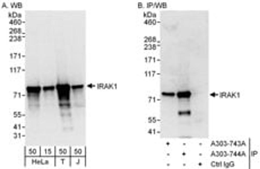 Detection of human IRAK1 by western blot and immunoprecipitation.