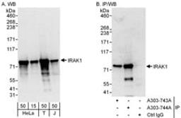 Detection of human IRAK1 by western blot and immunoprecipitation.