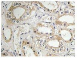 Immunohistochemistry-Paraffin: GRB 14 Antibody [NBP1-00863] - Immunohistochemistry (IHC) analyzes of GRB 14 (D123) pAb in paraffin-embedded human kidney tissue.