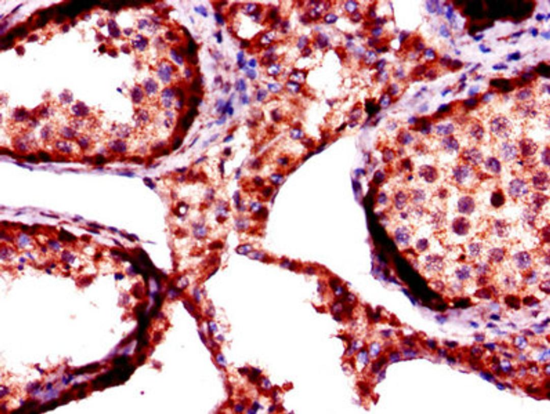 Immunohistochemistry of paraffin-embedded human testis tissue using CSB-PA008702LA01HU at dilution of 1:100