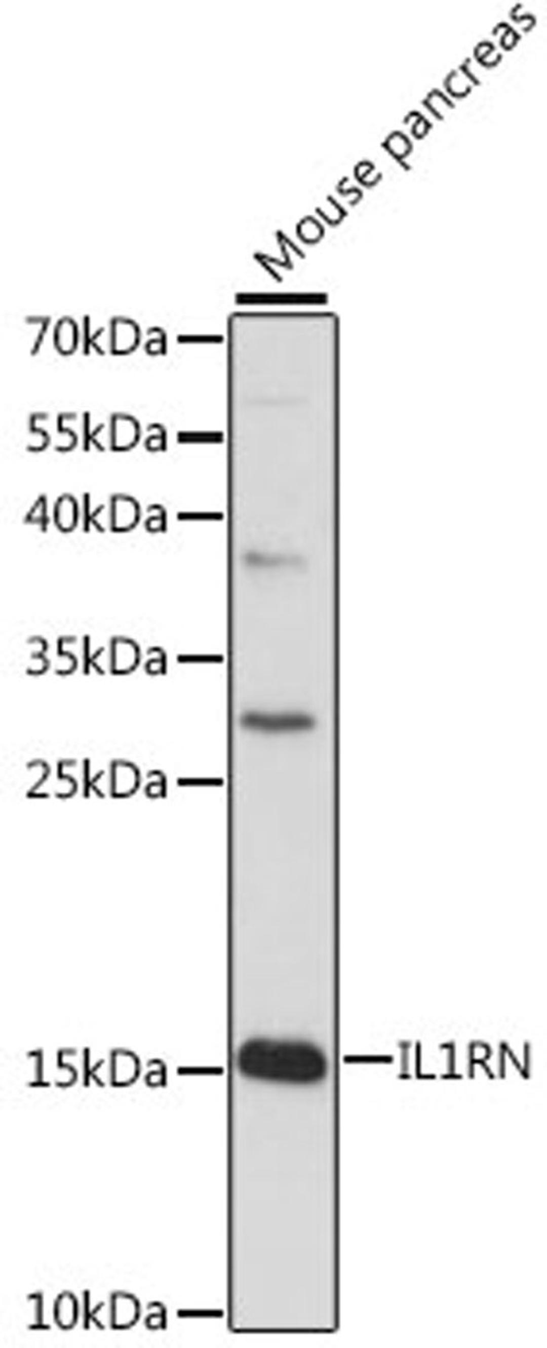 Western blot - IL1RN antibody (A16385)