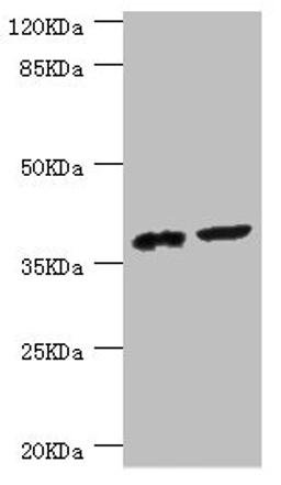 Western blot. All lanes: DEDD antibody at 0.56ug/ml. Lane 1: Mouse lung tissue. Lane 2: Mouse thymus tissue. Secondary. Goat polyclonal to rabbit IgG at 1/10000 dilution. Predicted band size: 37, 41 kDa. Observed band size: 37 kDa.
