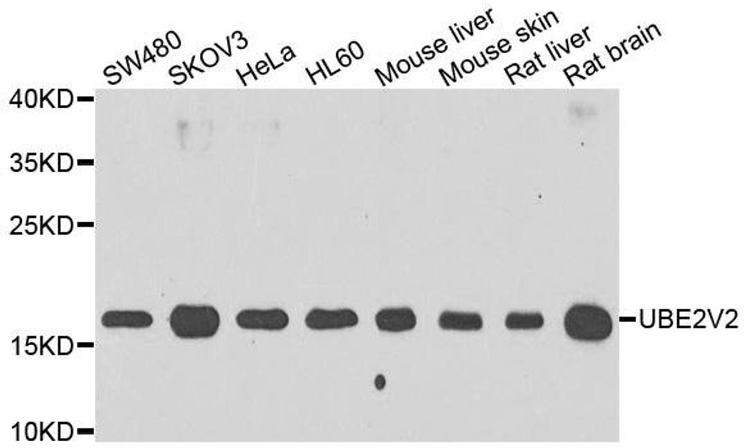 Western blot analysis of extracts of various cell lines using UBE2V2 antibody