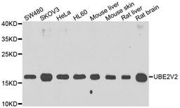 Western blot analysis of extracts of various cell lines using UBE2V2 antibody