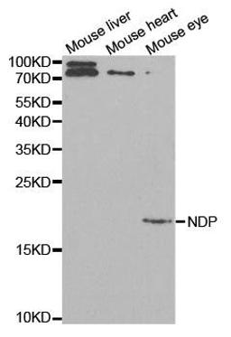 Western blot analysis of extracts of various cell lines using NDP antibody