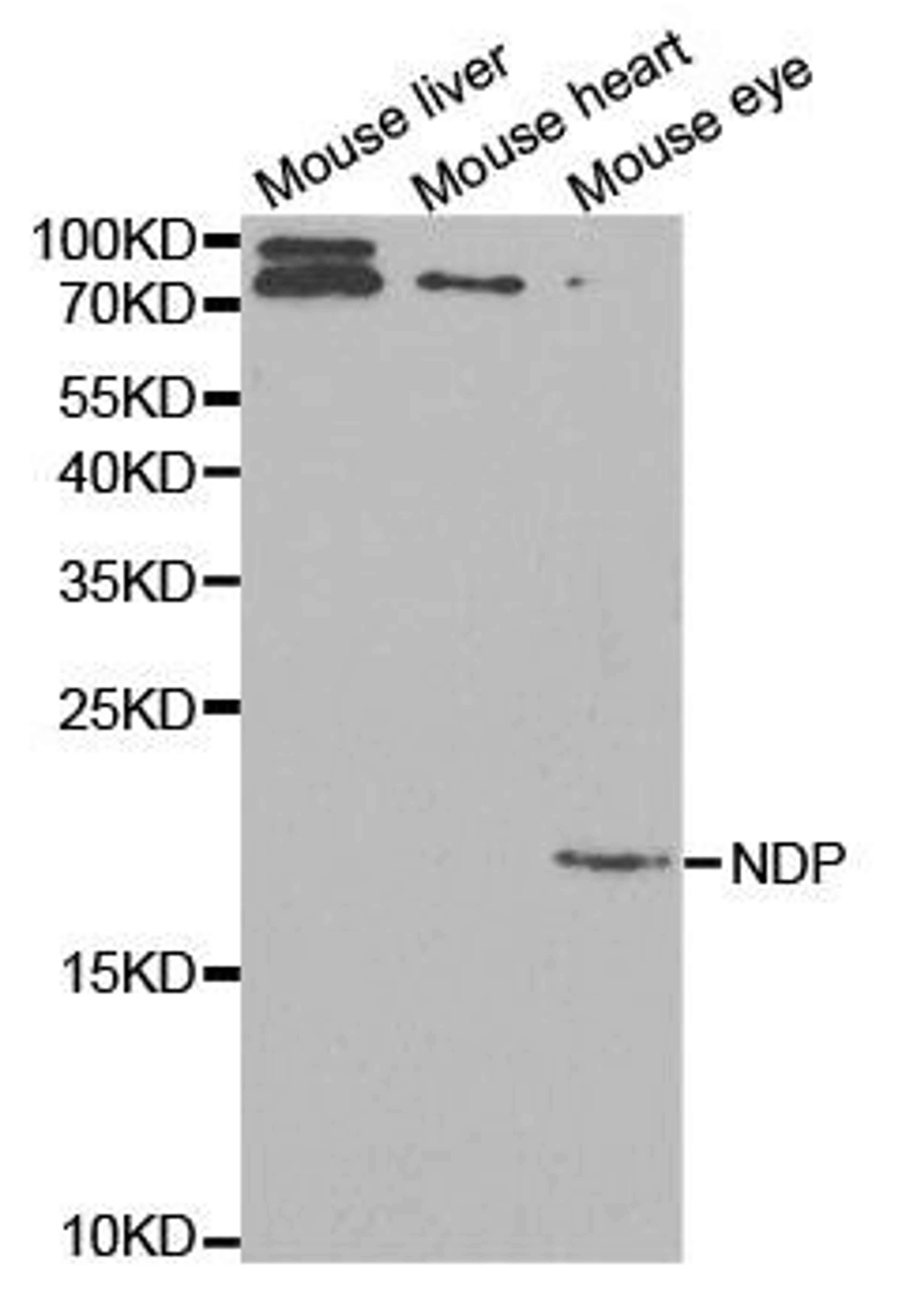 Western blot analysis of extracts of various cell lines using NDP antibody