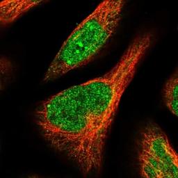 Immunocytochemistry/Immunofluorescence: APOL6 Antibody [NBP1-89032] - Staining of human cell line U-2 OS shows positivity in nucleus but not nucleoli.