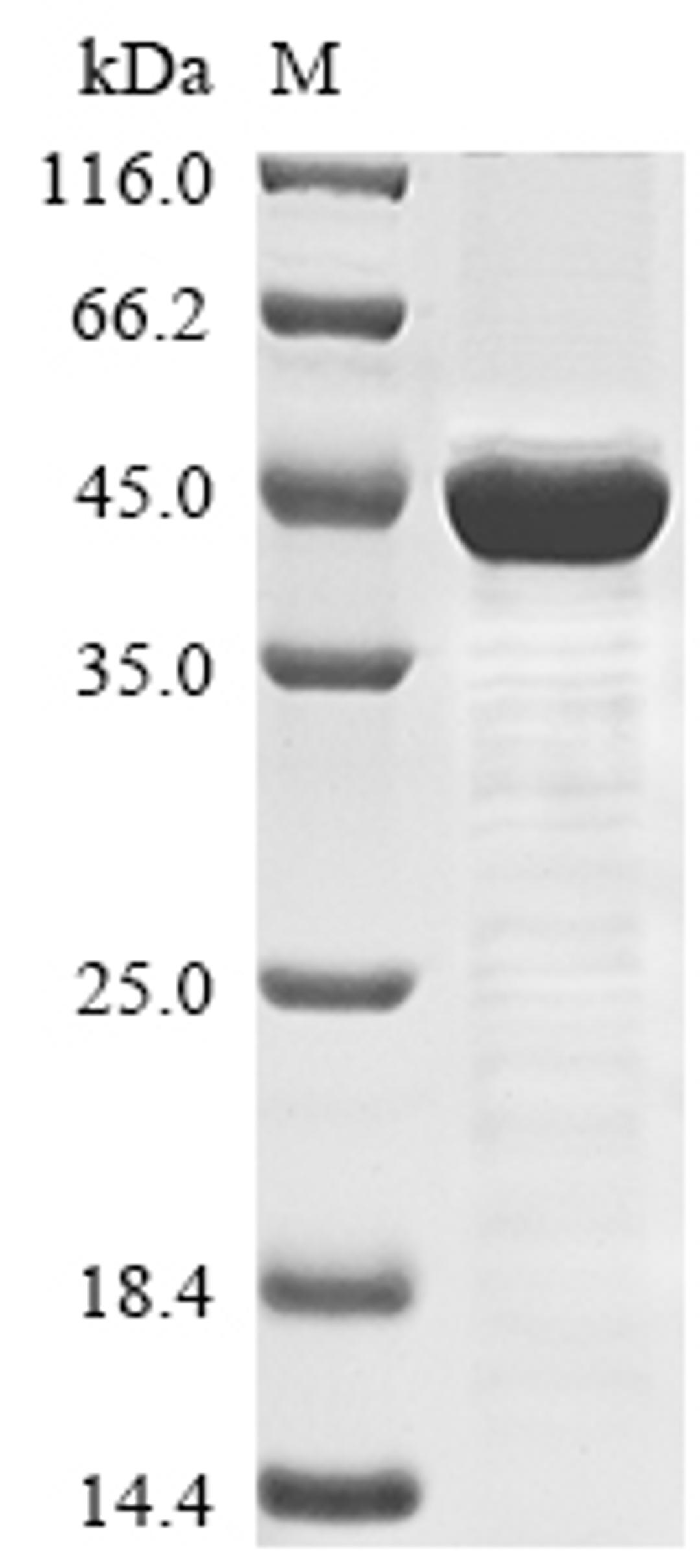 (Tris-Glycine gel) Discontinuous SDS-PAGE (reduced) with 5% enrichment gel and 15% separation gel.