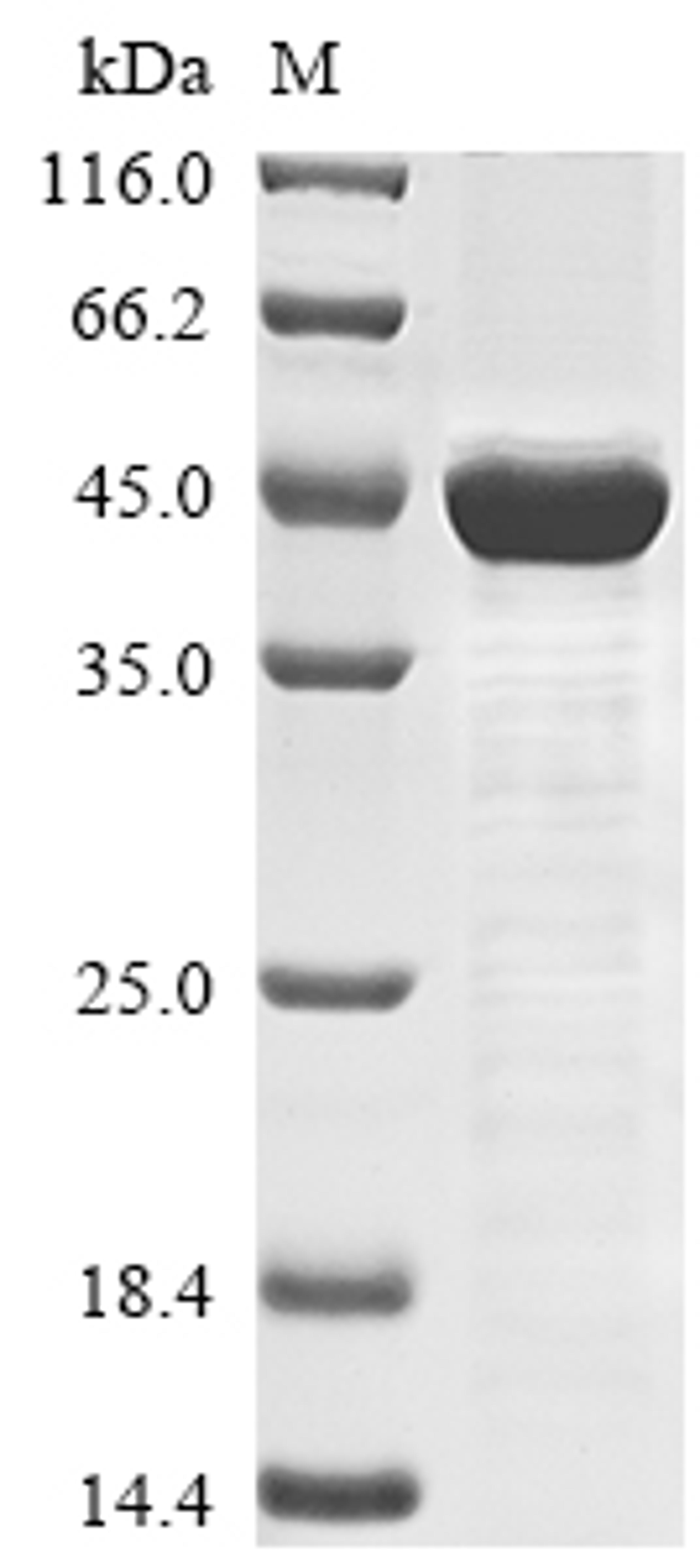 (Tris-Glycine gel) Discontinuous SDS-PAGE (reduced) with 5% enrichment gel and 15% separation gel.