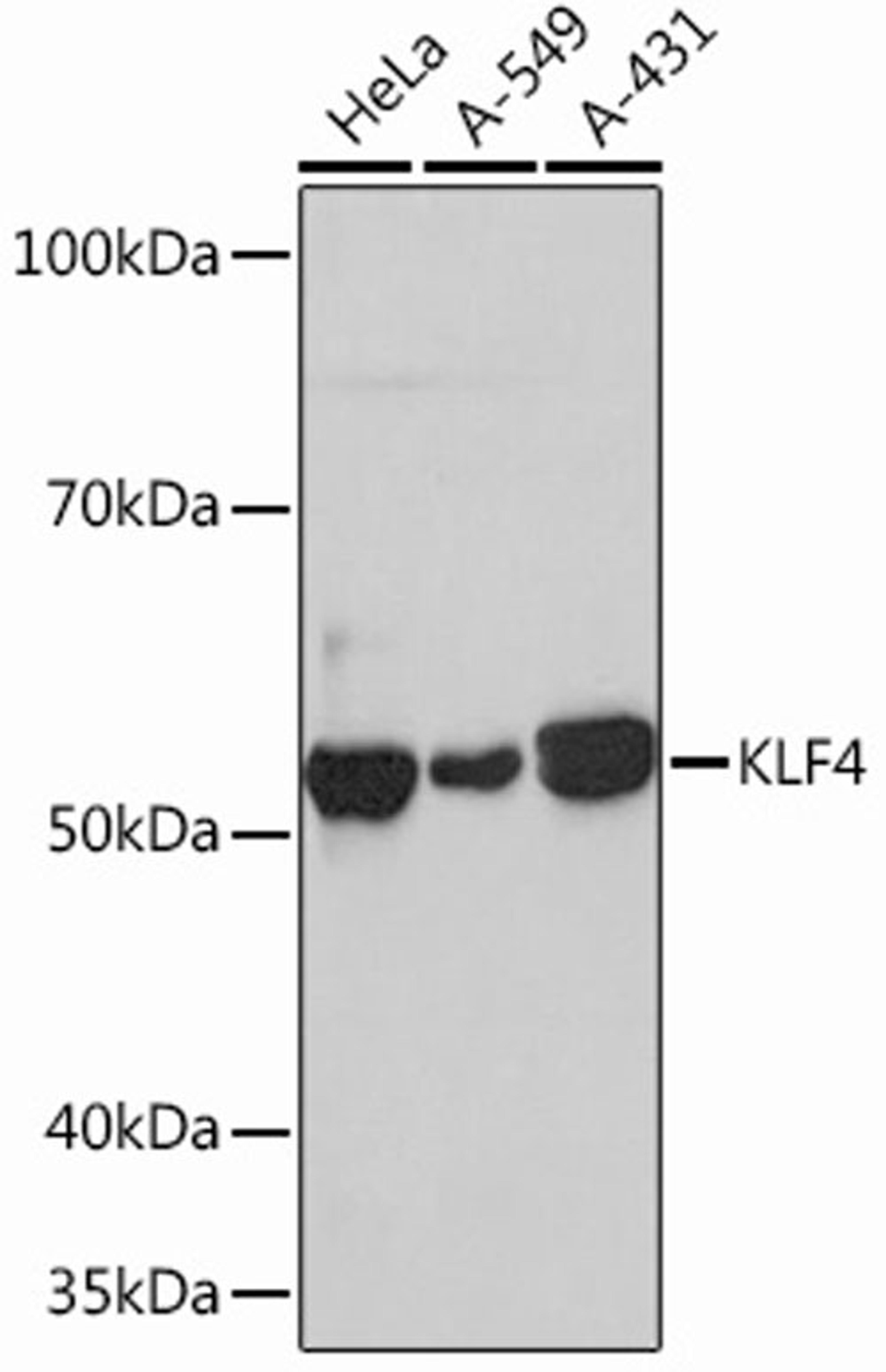 Western blot - KLF4 Rabbit mAb (A13673)