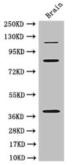 Western Blot. Positive WB detected in: Mouse brain tissue. All lanes: PDZRN3 antibody at 3ug/ml. Secondary. Goat polyclonal to rabbit IgG at 1/50000 dilution. Predicted band size: 120, 39, 81 kDa. Observed band size: 120, 81, 39 kDa. 