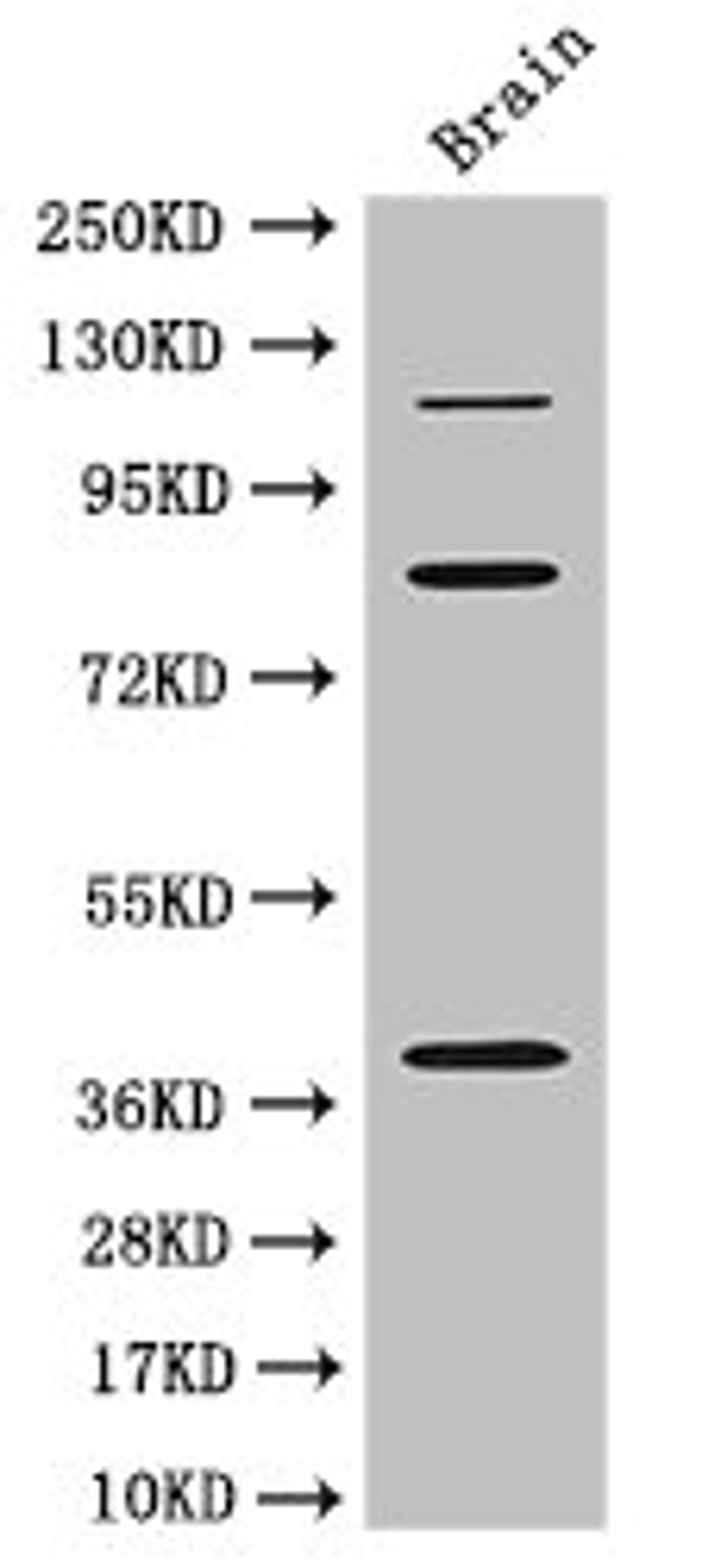 Western Blot. Positive WB detected in: Mouse brain tissue. All lanes: PDZRN3 antibody at 3ug/ml. Secondary. Goat polyclonal to rabbit IgG at 1/50000 dilution. Predicted band size: 120, 39, 81 kDa. Observed band size: 120, 81, 39 kDa. 