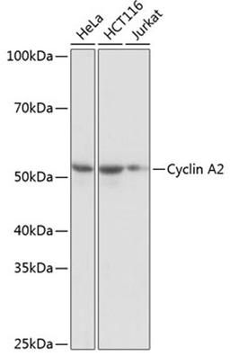 Western blot - Cyclin A2 antibody (A19036)