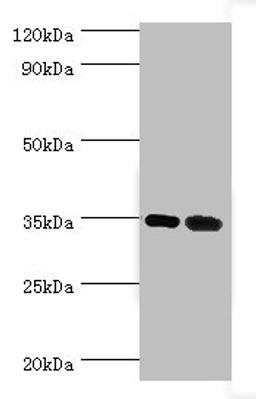 Western blot. All lanes: MAGEA6 antibody at 7ug/ml. Lane 1: Rat brain tissue. Lane 2: Rat gonad tissue. Secondary. Goat polyclonal to rabbit IgG at 1/10000 dilution. Predicted band size: 35 kDa. Observed band size: 35 kDa. 