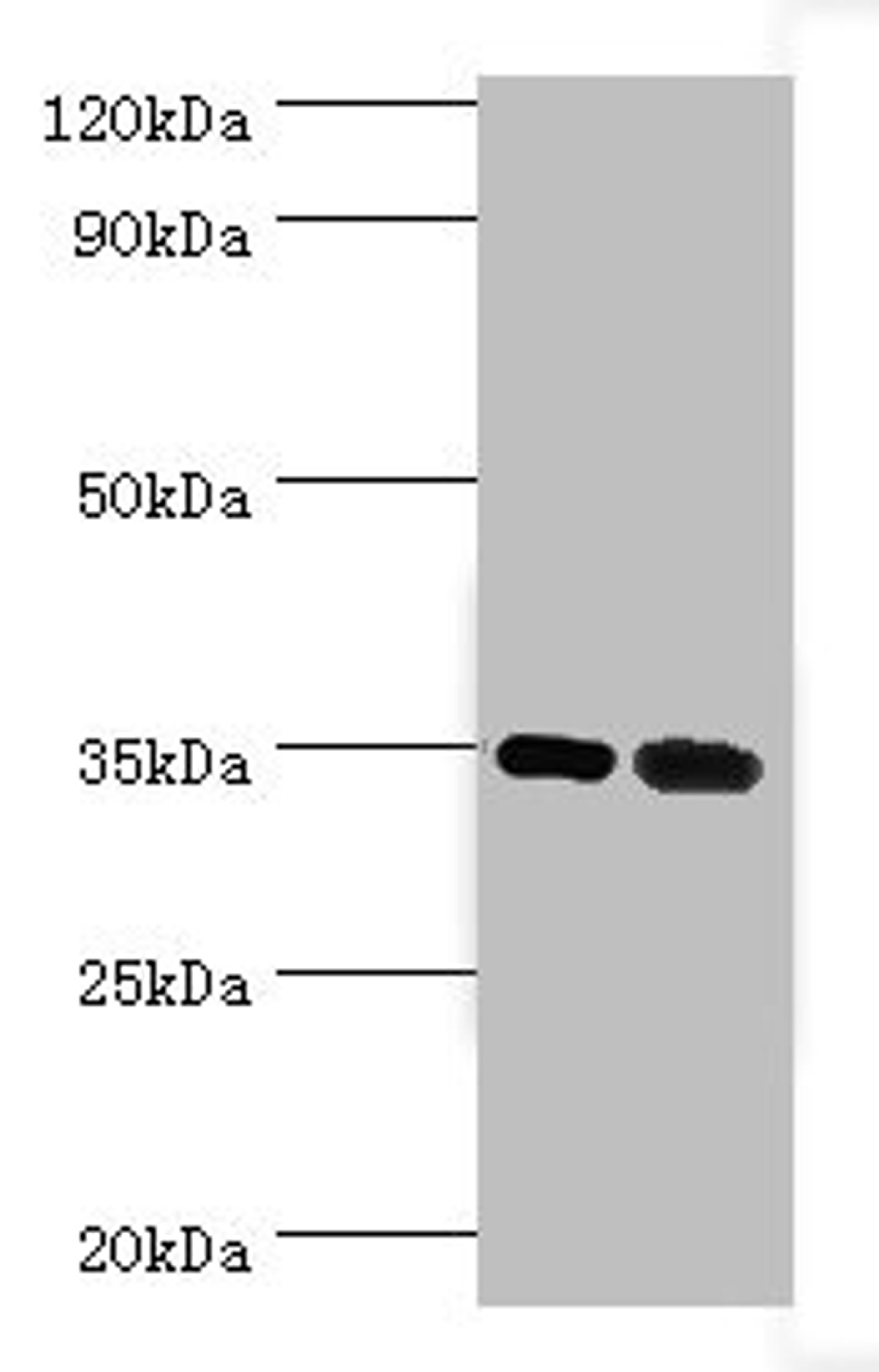 Western blot. All lanes: MAGEA6 antibody at 7ug/ml. Lane 1: Rat brain tissue. Lane 2: Rat gonad tissue. Secondary. Goat polyclonal to rabbit IgG at 1/10000 dilution. Predicted band size: 35 kDa. Observed band size: 35 kDa. 