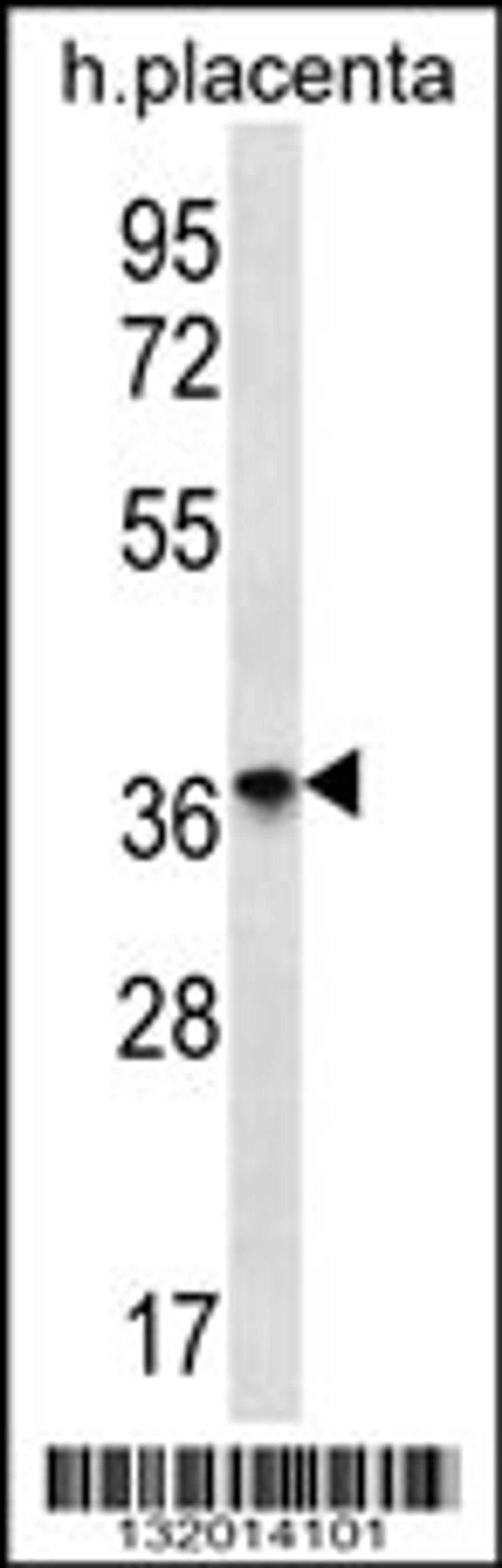 Western blot analysis in human placenta tissue lysates (35ug/lane).