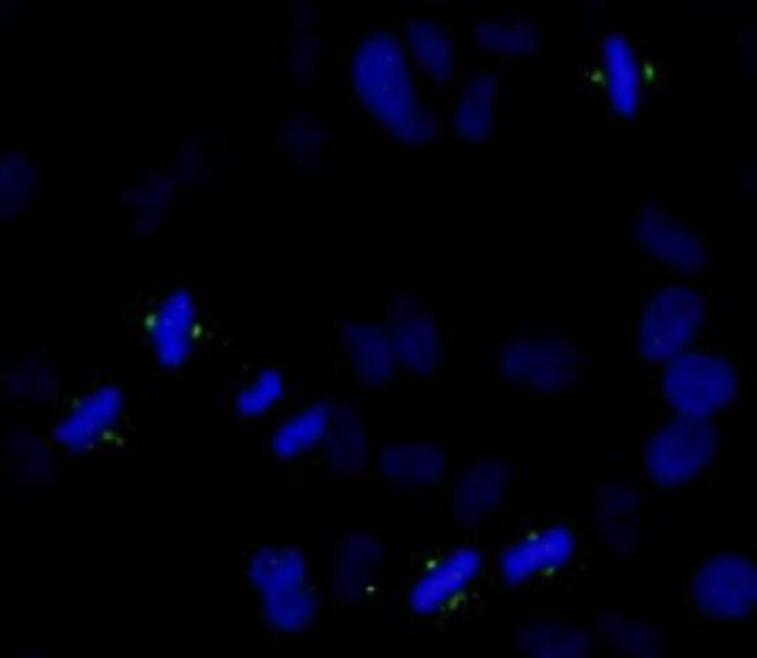 Immunocytochemistry/Immunofluorescence: Aurora A [p Thr288] Antibody [NB100-2371] - NBF-fixed asynchronous  HeLa cells.  Antibody: Affinity purified rabbit anti-Phospho-  Aurora A (T288) (NB100-2371) used at a dilution of  1:250.  Detection:  Anti-rabbit IgG-FITC conjugated (NB7159) used at a dilution of 1:100.