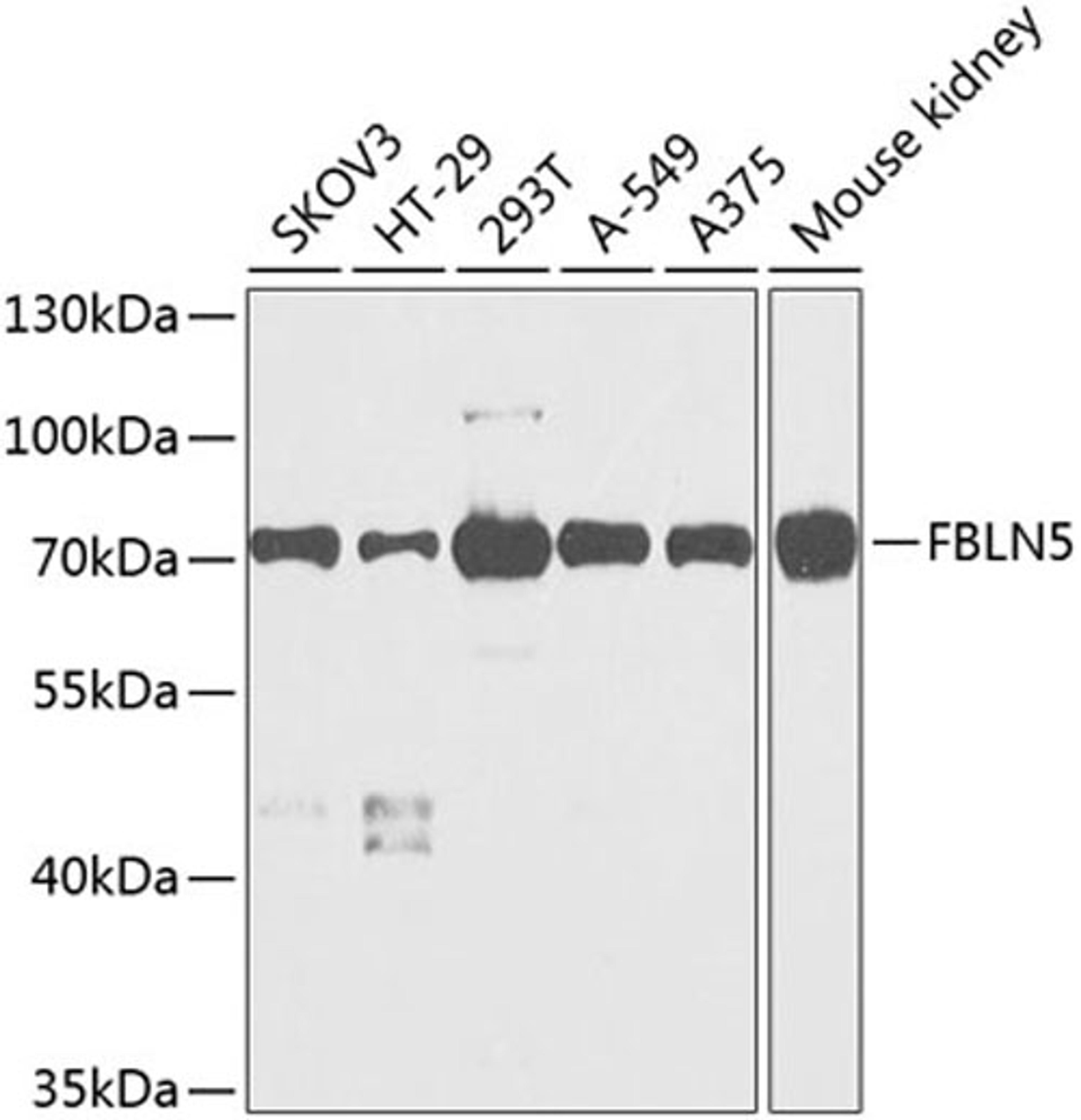 Western blot - FBLN5 antibody (A9961)