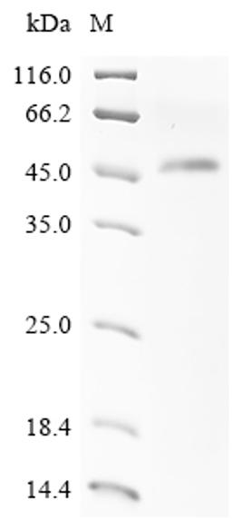 (Tris-Glycine gel) Discontinuous SDS-PAGE (reduced) with 5% enrichment gel and 15% separation gel.