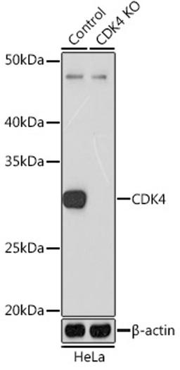 Western blot - CDK4 Rabbit mAb (A11136)