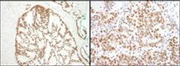 Detection of human and mouse SF3B3 by immunohistochemistry.