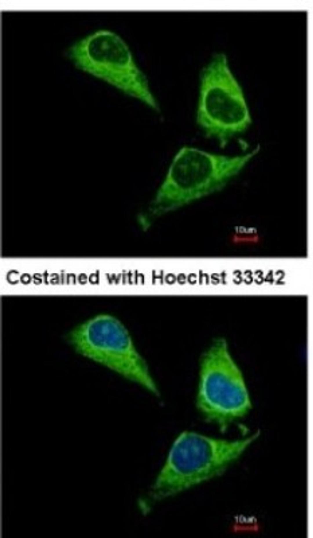 Immunocytochemistry/Immunofluorescence: ARHGAP15 Antibody [NBP2-15452] - Analysis of methanol-fixed HeLa, using antibody at 1:500 dilution.