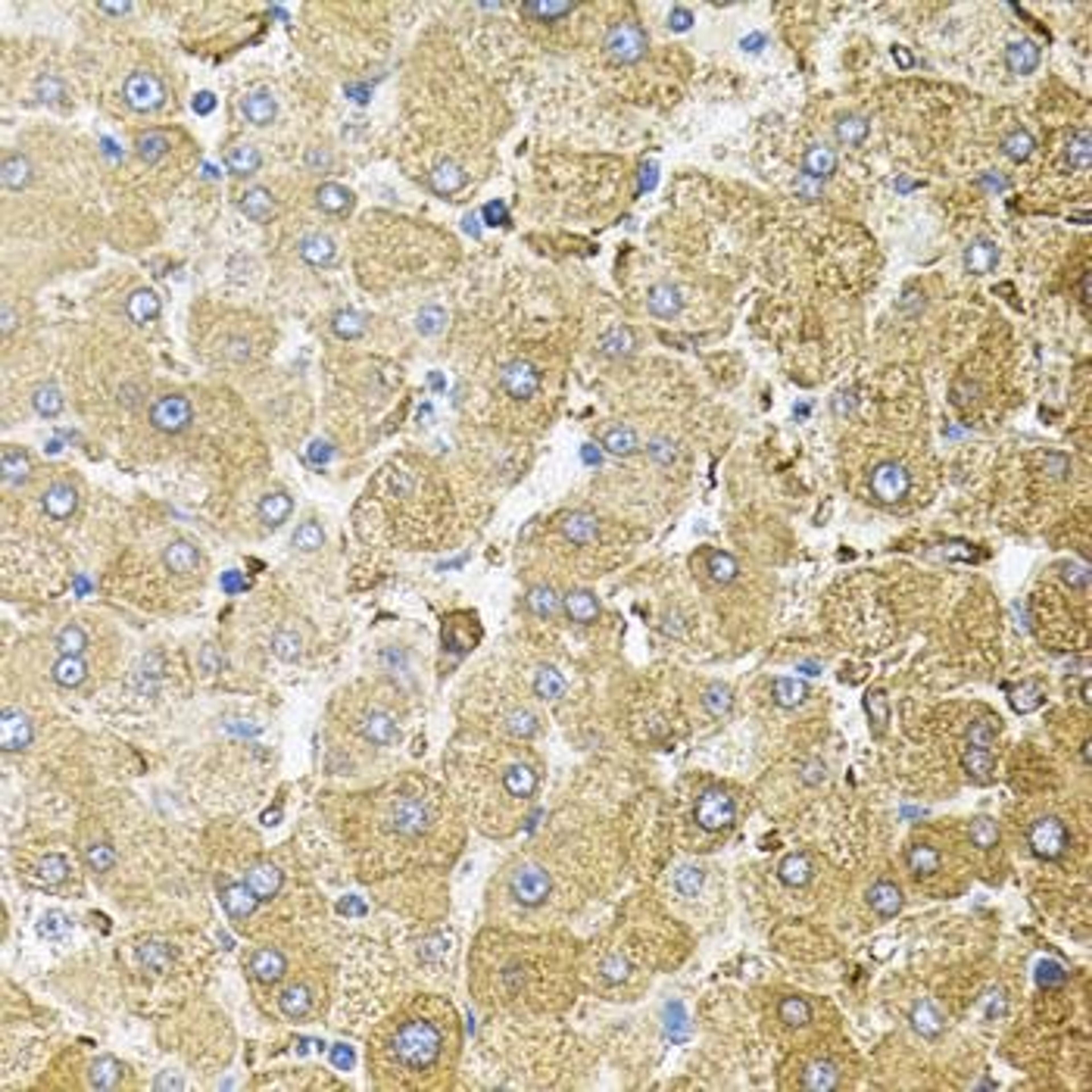 Immunohistochemical staining of mouse brain tissue using CEP164 antibody