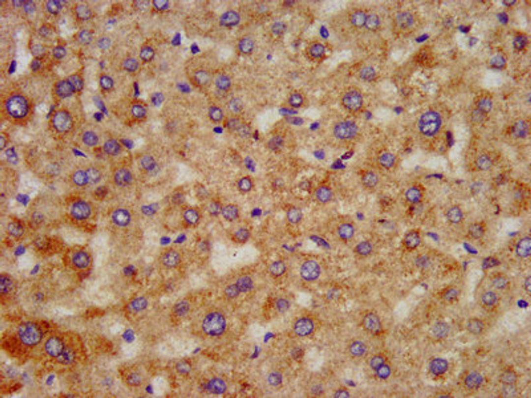 IHC image of CSB-PA891938LA01HU diluted at 1:300 and staining in paraffin-embedded human liver tissue performed on a Leica BondTM system. After dewaxing and hydration, antigen retrieval was mediated by high pressure in a citrate buffer (pH 6.0). Section was blocked with 10% normal goat serum 30min at RT. Then primary antibody (1% BSA) was incubated at 4°C overnight. The primary is detected by a biotinylated secondary antibody and visualized using an HRP conjugated SP system.