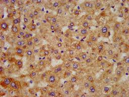IHC image of CSB-PA891938LA01HU diluted at 1:300 and staining in paraffin-embedded human liver tissue performed on a Leica BondTM system. After dewaxing and hydration, antigen retrieval was mediated by high pressure in a citrate buffer (pH 6.0). Section was blocked with 10% normal goat serum 30min at RT. Then primary antibody (1% BSA) was incubated at 4°C overnight. The primary is detected by a biotinylated secondary antibody and visualized using an HRP conjugated SP system.