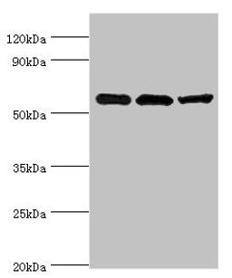 Western blot. All lanes: Aldehyde dehydrogenase X, mitochondrial antibody at 4ug/ml. Lane 1: Hela whole cell lysate. Lane 2: Rat brain tissue. Lane 3: HepG2 whole cell lysate. Secondary. Goat polyclonal to rabbit IgG at 1/10000 dilution. Predicted band size: 57 kDa. Observed band size: 57 kDa. 