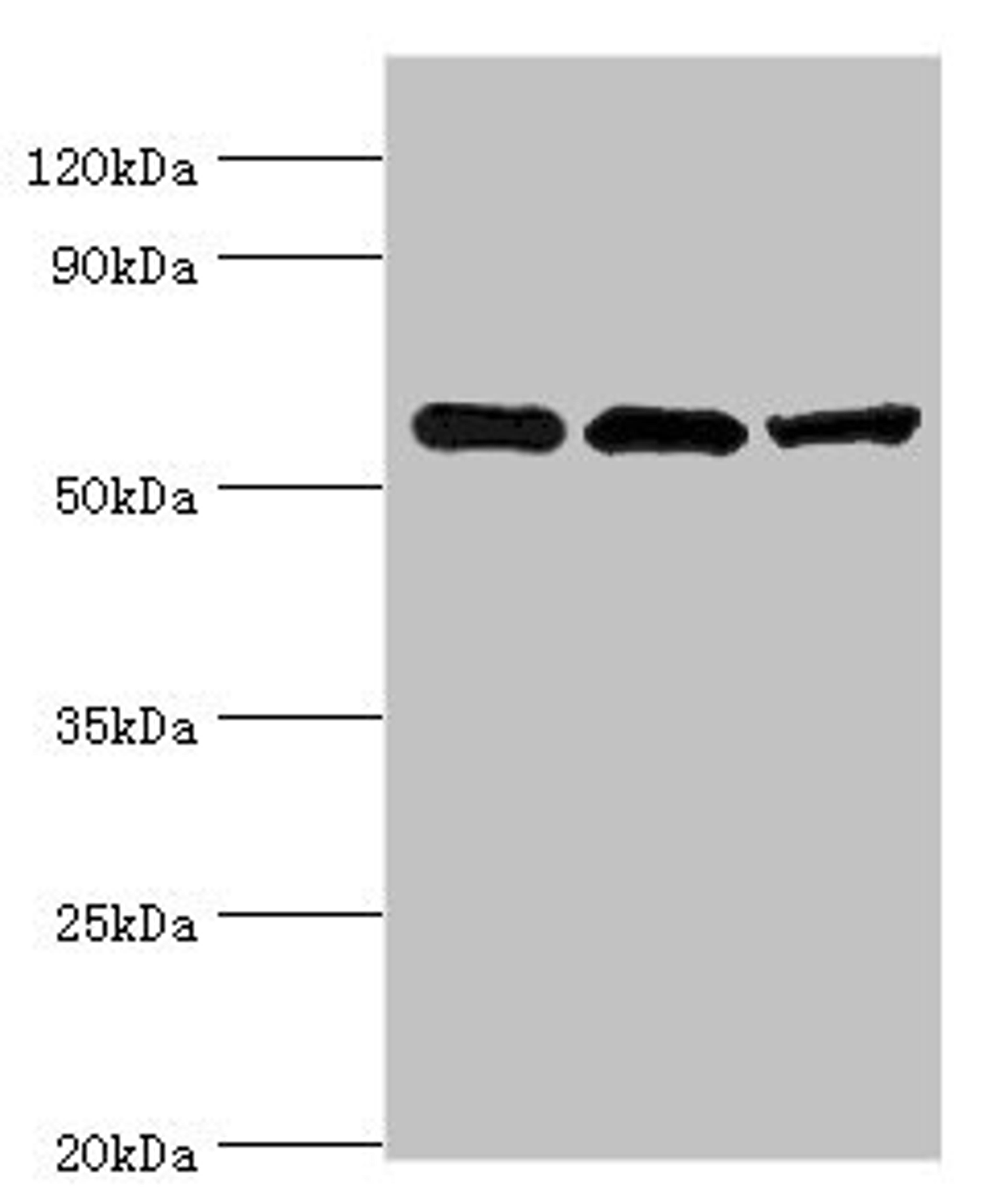 Western blot. All lanes: Aldehyde dehydrogenase X, mitochondrial antibody at 4ug/ml. Lane 1: Hela whole cell lysate. Lane 2: Rat brain tissue. Lane 3: HepG2 whole cell lysate. Secondary. Goat polyclonal to rabbit IgG at 1/10000 dilution. Predicted band size: 57 kDa. Observed band size: 57 kDa. 
