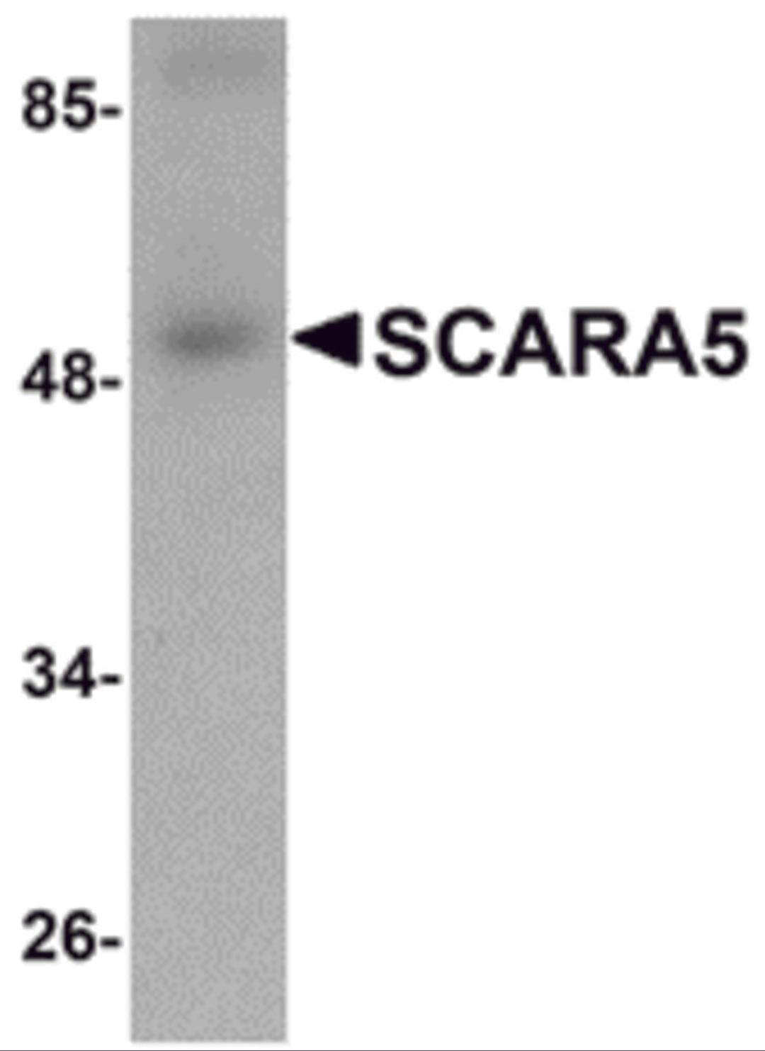 Western blot analysis of SCARA5 in human liver tissue lysate with SCARA5 antibody at 1 μg/mL.