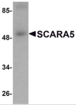 Western blot analysis of SCARA5 in human liver tissue lysate with SCARA5 antibody at 1 μg/mL.