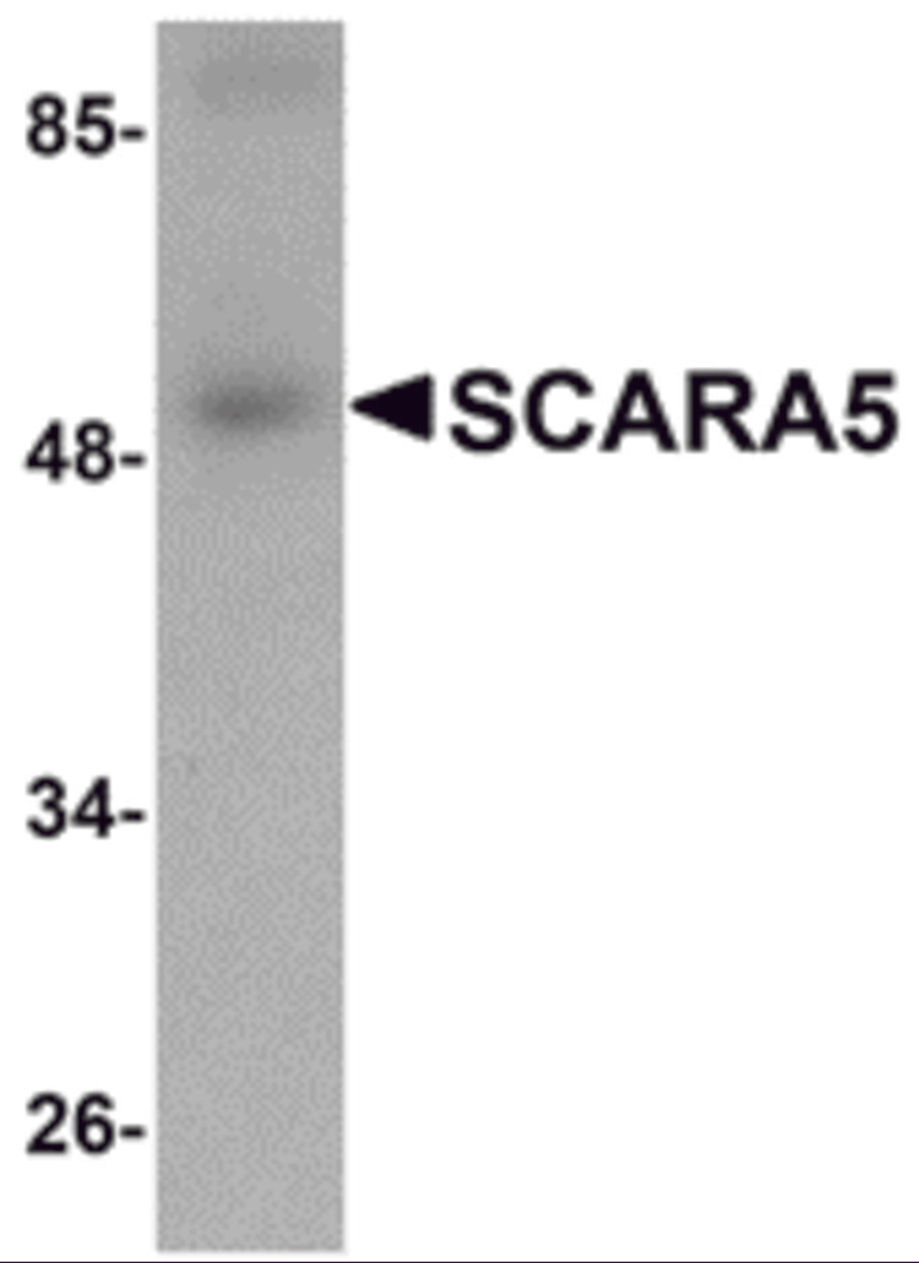 Western blot analysis of SCARA5 in human liver tissue lysate with SCARA5 antibody at 1 μg/mL.