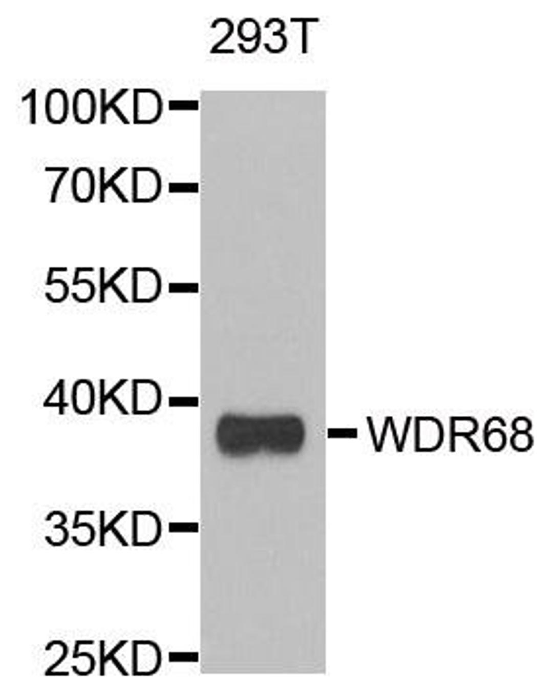 Western blot analysis of extracts of 293T cell line using WDR68 antibody