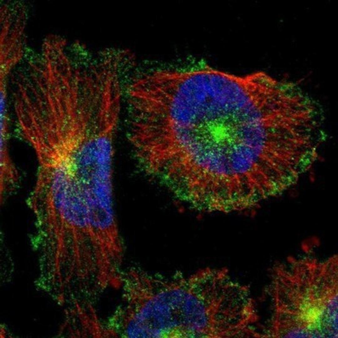 Immunocytochemistry/Immunofluorescence: Myoferlin Antibody [NBP1-84694] - Staining of human cell line U-251MG shows positivity in plasma membrane & vesicles.