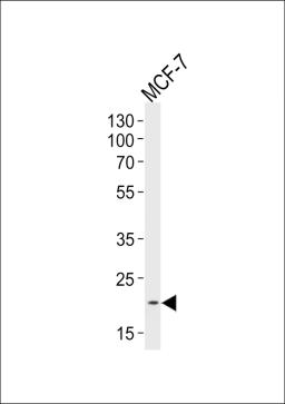 Western blot analysis of lysate from MCF-7 cell line, using NOS1AP Antibody at 1:1000 at each lane.