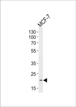 Western blot analysis of lysate from MCF-7 cell line, using NOS1AP Antibody at 1:1000 at each lane.