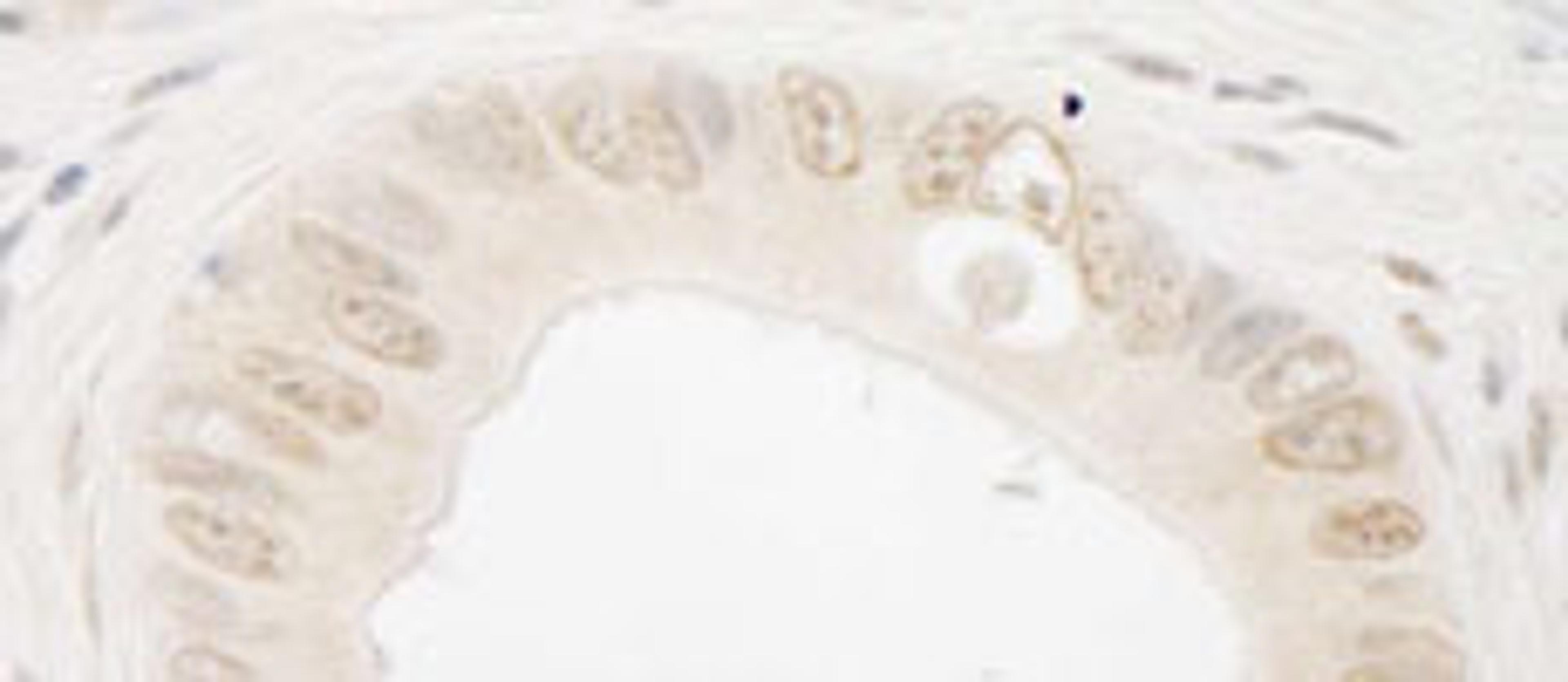 Detection of human ARIP4 by immunohistochemistry.